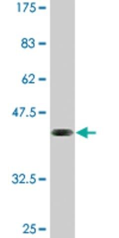Monoclonal Anti-ELF5 antibody produced in mouse