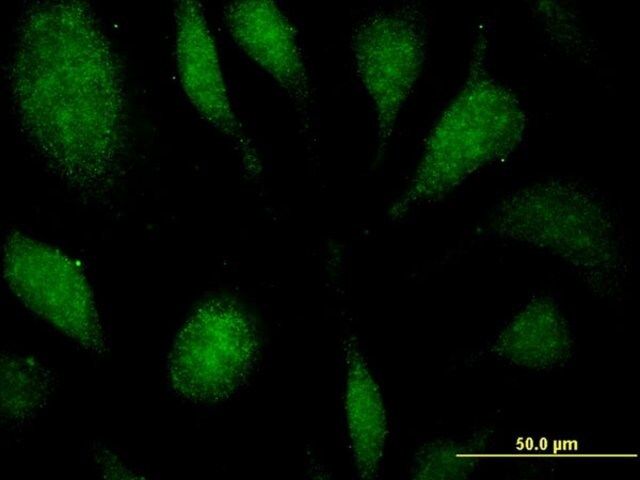 Monoclonal Anti-EEF1D antibody produced in mouse