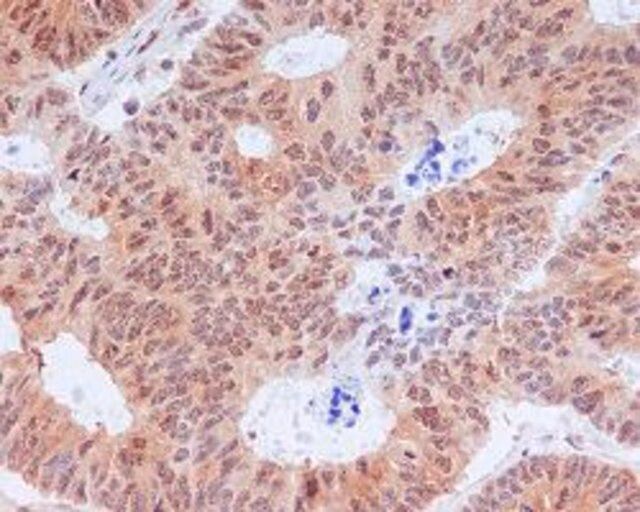 Monoclonal Anti-EIF2S1 (phospho S51) antibody produced in rabbit