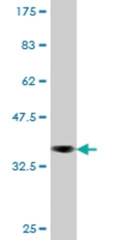 Monoclonal Anti-EXO1, (C-terminal) antibody produced in mouse