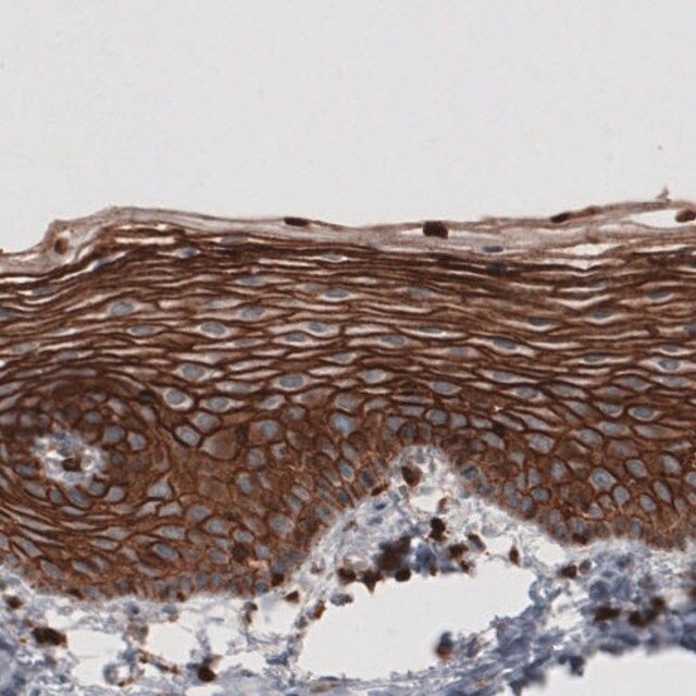 Monoclonal Anti-EZR antibody produced in mouse