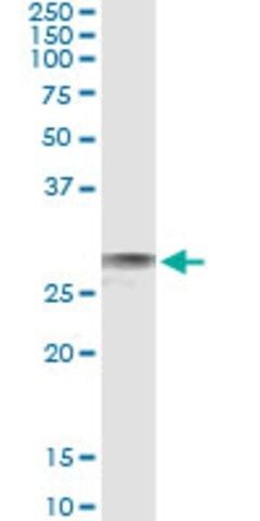 Monoclonal Anti-EXOSC3, (C-terminal) antibody produced in mouse