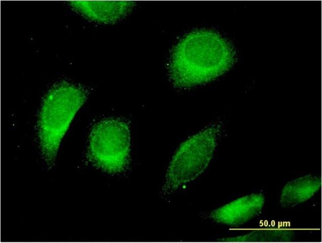 Monoclonal Anti-CLCN6, (C-terminal) antibody produced in mouse