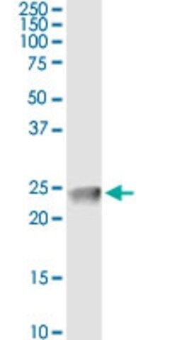 Monoclonal Anti-CLDN4 antibody produced in mouse