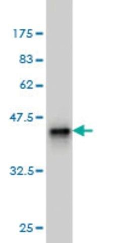 Monoclonal Anti-DAZ1 antibody produced in mouse