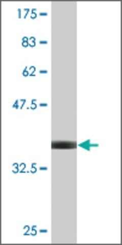 Monoclonal Anti-DAB2, (C-terminal) antibody produced in mouse