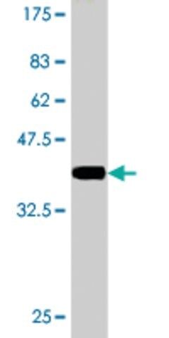 Monoclonal Anti-DCP1A antibody produced in mouse