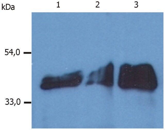 Monoclonal Anti-Cytokeratin 18 antibody produced in mouse