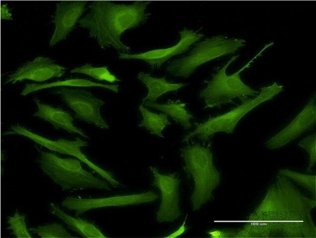 Monoclonal Anti-DAPK2, (C-terminal) antibody produced in mouse
