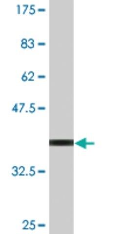 Monoclonal Anti-DAP antibody produced in mouse
