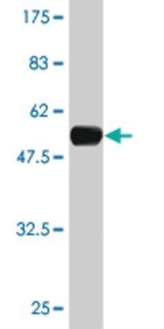 Monoclonal Anti-DHRS9 antibody produced in mouse