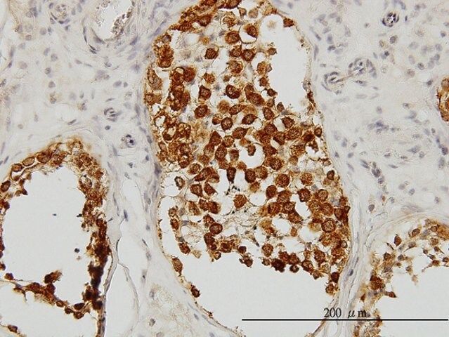 Monoclonal Anti-DAZ1 antibody produced in mouse