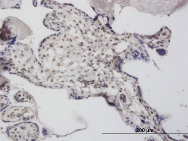 Monoclonal Anti-DCPS antibody produced in mouse