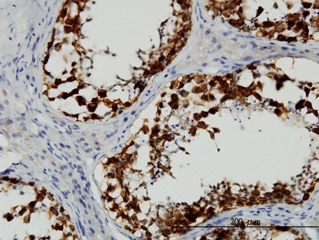 Monoclonal Anti-DAZ1 antibody produced in mouse