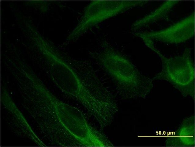 Monoclonal Anti-BST2 antibody produced in mouse