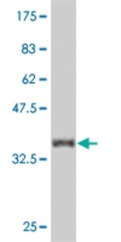 Monoclonal Anti-CAMK2D antibody produced in mouse