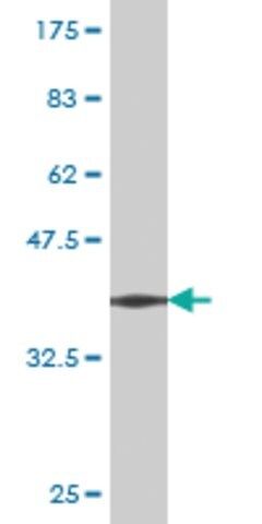 Monoclonal Anti-CCT7 antibody produced in mouse