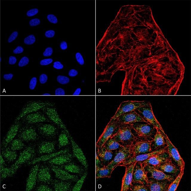 Monoclonal Anti-CD74 antibody produced in mouse