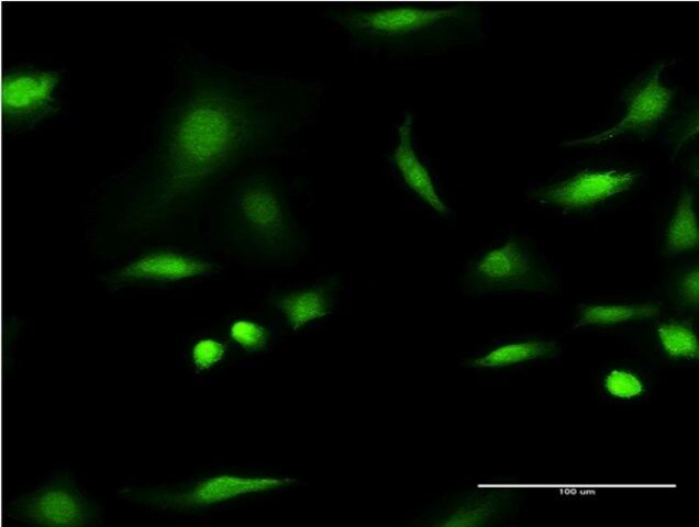 Monoclonal Anti-C1D antibody produced in mouse