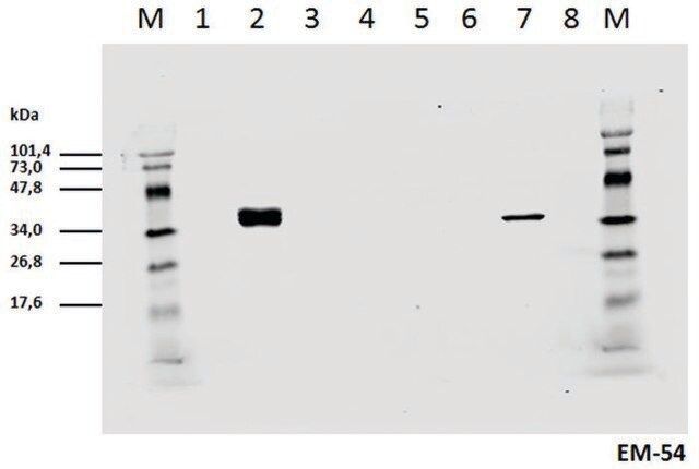 Monoclonal Anti-CD3 zeta (PhosphoTyr142) antibody produced in mouse