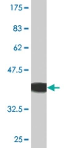 Monoclonal Anti-ACVR2B antibody produced in mouse