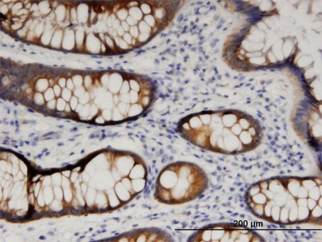 Monoclonal Anti-ARFIP1, (N-terminal) antibody produced in mouse