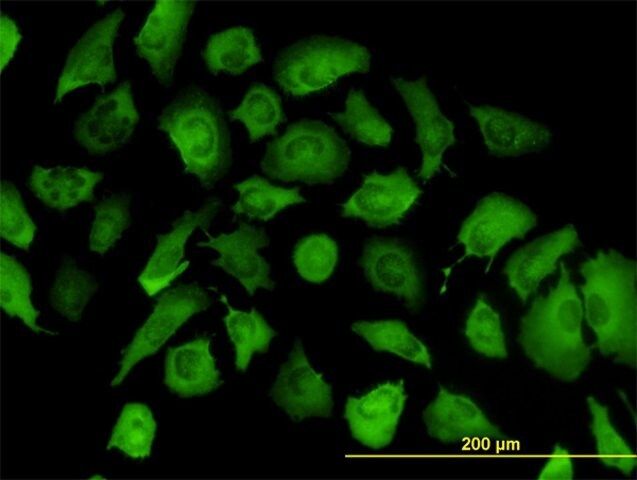 Monoclonal Anti-ANXA2, (C-terminal) antibody produced in mouse