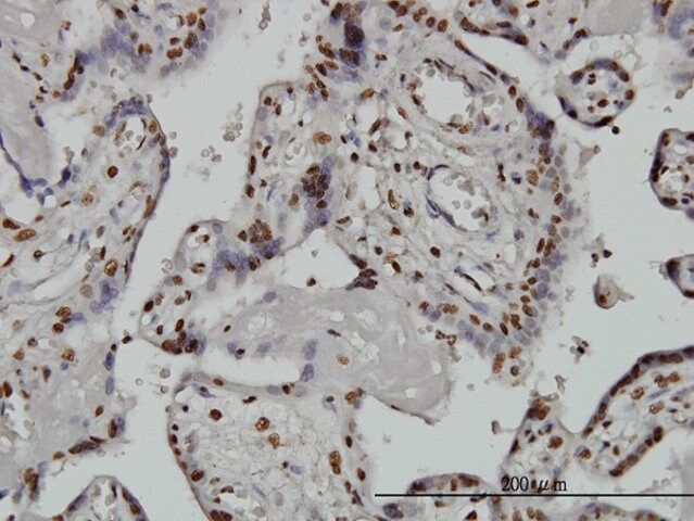 Monoclonal Anti-ARID1B antibody produced in mouse