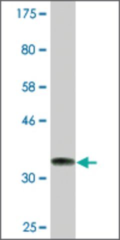 Monoclonal Anti-ARMC4, (C-terminal) antibody produced in mouse