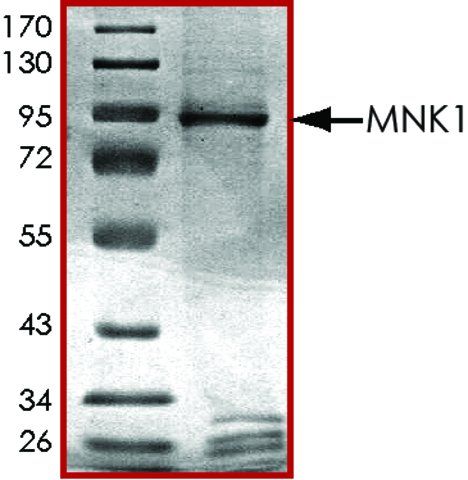 MNK1, active, GST tagged human