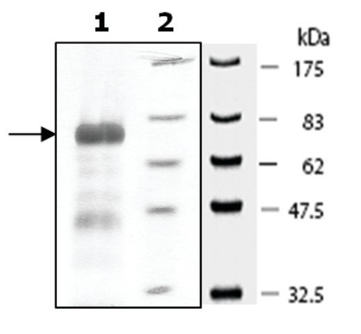 MNK1 active human