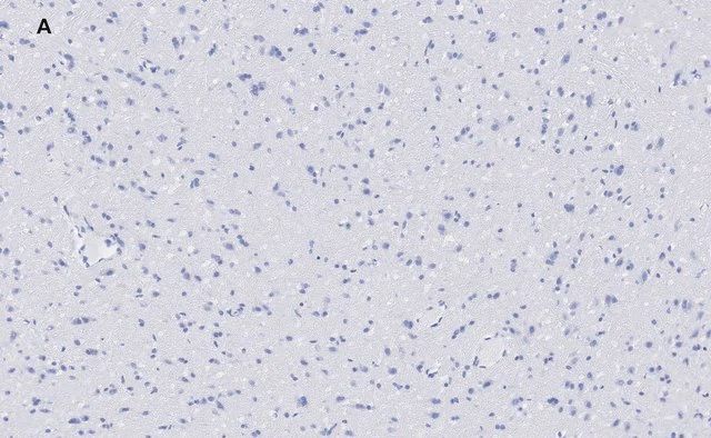 Anti-VGluT1 Antibody, clone 4O15, ZooMAb<sup>®</sup> Rabbit Monoclonal