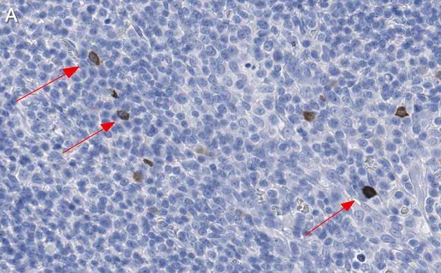 Anti-TNFβ/LTA Antibody, clone 3B20-H2 ZooMAb<sup>®</sup> Rabbit Monoclonal
