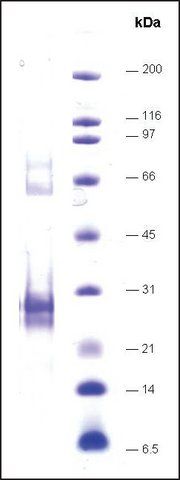 LXRα-ligand binding domain (215-667) human