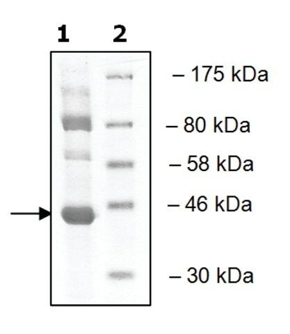 Lok1 active human