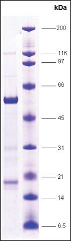 FXR (Farnesoid-X-activated receptor) human