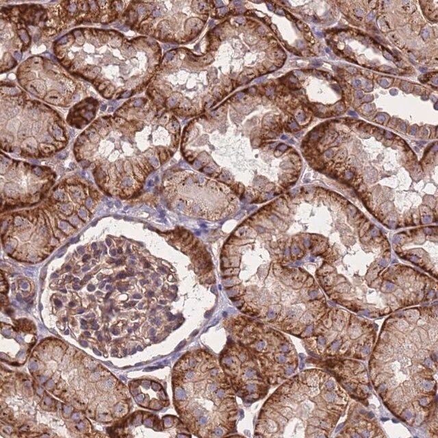 Anti-ZNF248 antibody produced in rabbit