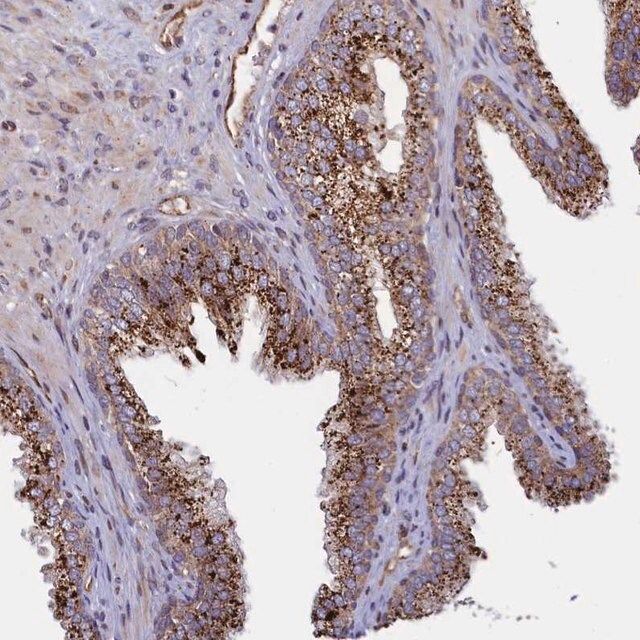 Anti-ZNF577 antibody produced in rabbit