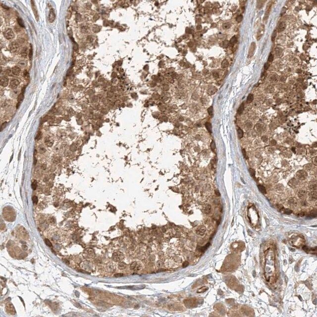 Anti-ZNF653 antibody produced in rabbit