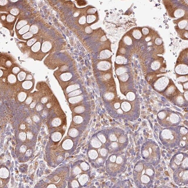 Anti-ZNF266 antibody produced in rabbit