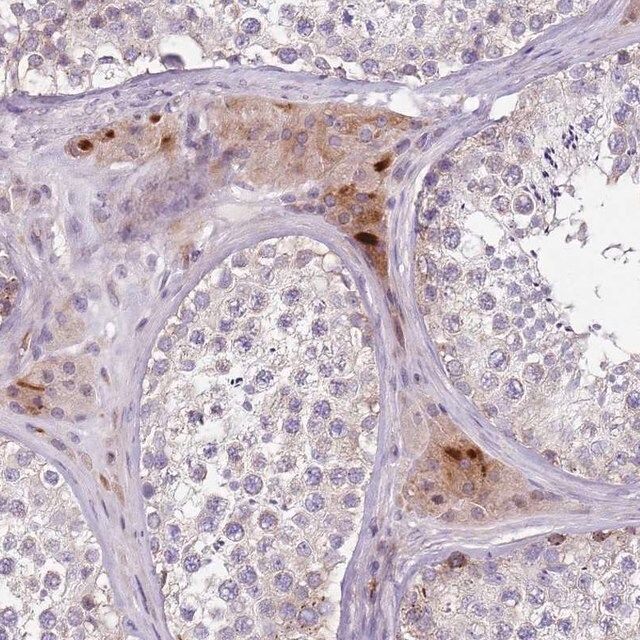 Anti-ZNF583 antibody produced in rabbit