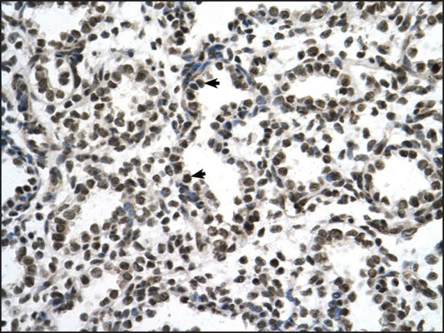 Anti-ZNF706 antibody produced in rabbit