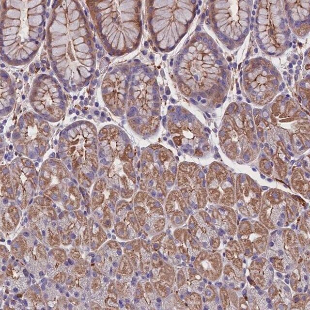 Anti-ZNF749 antibody produced in rabbit