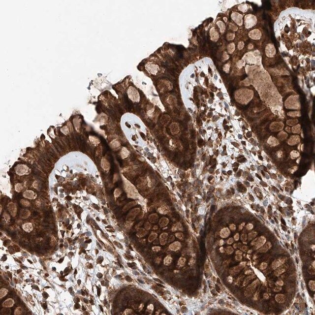 Anti-ZFP28 antibody produced in rabbit