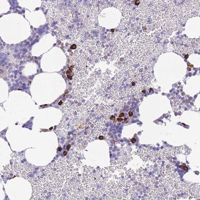 Anti-ZFP62 antibody produced in rabbit