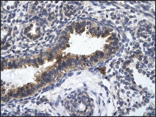 Anti-ZFR antibody produced in rabbit