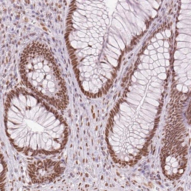 Anti-ZFR2 antibody produced in rabbit