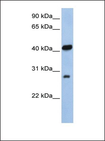 Anti-ZFAND3 antibody produced in rabbit