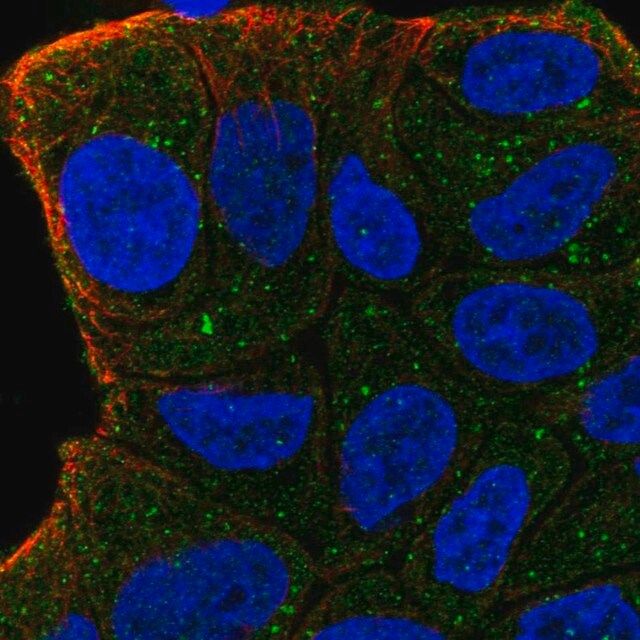 Anti-ZFYVE9 antibody produced in rabbit