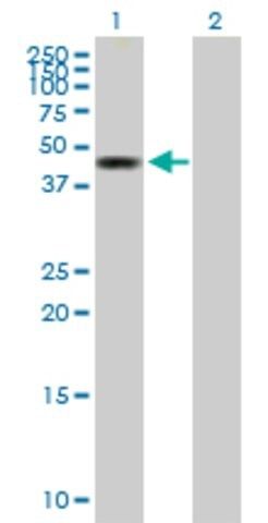 Anti-ZMYND10 antibody produced in mouse